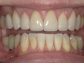  html    head  title 500 Internal Server Error  title   head    body    center  h1 500 Internal Server Error  h1   center    hr  center nginx 1.29.3  center     body     html 