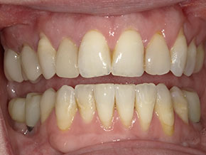  html    head  title 500 Internal Server Error  title   head    body    center  h1 500 Internal Server Error  h1   center    hr  center nginx 1.29.3  center     body     html 