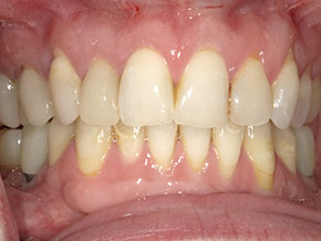  html    head  title 500 Internal Server Error  title   head    body    center  h1 500 Internal Server Error  h1   center    hr  center nginx 1.29.3  center     body     html 