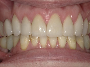  html    head  title 500 Internal Server Error  title   head    body    center  h1 500 Internal Server Error  h1   center    hr  center nginx 1.29.3  center     body     html 