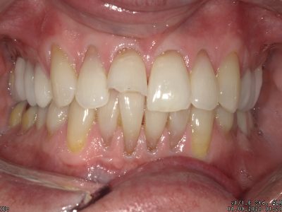 <html>
<head><title>500 Internal Server Error</title></head>
<body>
<center><h1>500 Internal Server Error</h1></center>
<hr><center>nginx/1.29.3</center>
</body>
</html>