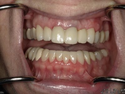 <html>
<head><title>500 Internal Server Error</title></head>
<body>
<center><h1>500 Internal Server Error</h1></center>
<hr><center>nginx/1.29.3</center>
</body>
</html>