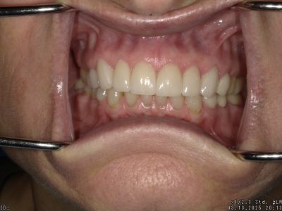  html    head  title 500 Internal Server Error  title   head    body    center  h1 500 Internal Server Error  h1   center    hr  center nginx 1.29.3  center     body     html 