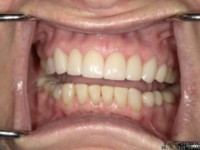 <html>
<head><title>500 Internal Server Error</title></head>
<body>
<center><h1>500 Internal Server Error</h1></center>
<hr><center>nginx/1.29.3</center>
</body>
</html>