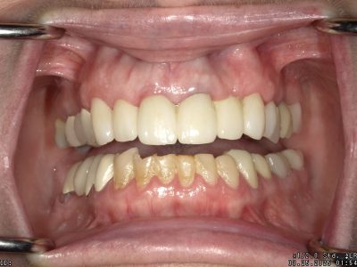 <html>
<head><title>500 Internal Server Error</title></head>
<body>
<center><h1>500 Internal Server Error</h1></center>
<hr><center>nginx/1.29.3</center>
</body>
</html>