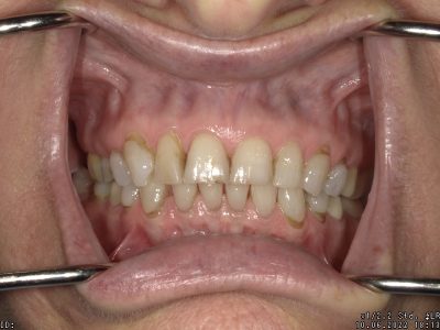  html    head  title 500 Internal Server Error  title   head    body    center  h1 500 Internal Server Error  h1   center    hr  center nginx 1.29.3  center     body     html 