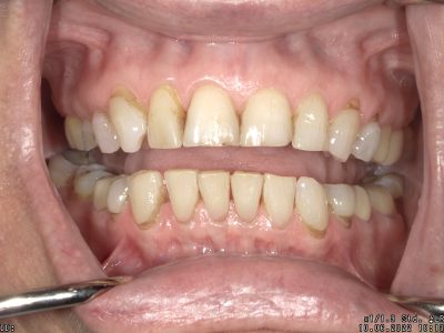 <html>
<head><title>500 Internal Server Error</title></head>
<body>
<center><h1>500 Internal Server Error</h1></center>
<hr><center>nginx/1.29.3</center>
</body>
</html>