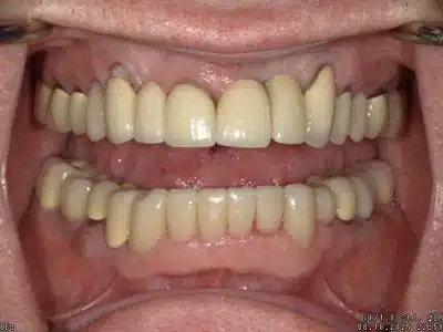 <html>
<head><title>500 Internal Server Error</title></head>
<body>
<center><h1>500 Internal Server Error</h1></center>
<hr><center>nginx/1.29.3</center>
</body>
</html>