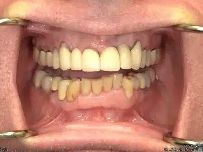 <html>
<head><title>500 Internal Server Error</title></head>
<body>
<center><h1>500 Internal Server Error</h1></center>
<hr><center>nginx/1.29.3</center>
</body>
</html>