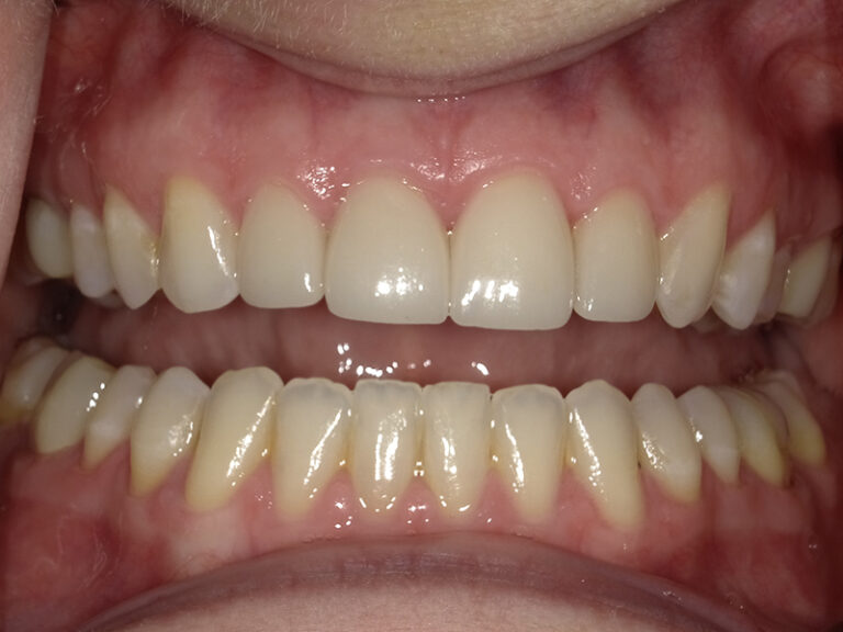  html    head  title 500 Internal Server Error  title   head    body    center  h1 500 Internal Server Error  h1   center    hr  center nginx 1.29.3  center     body     html 