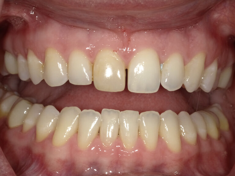  html    head  title 500 Internal Server Error  title   head    body    center  h1 500 Internal Server Error  h1   center    hr  center nginx 1.29.3  center     body     html 