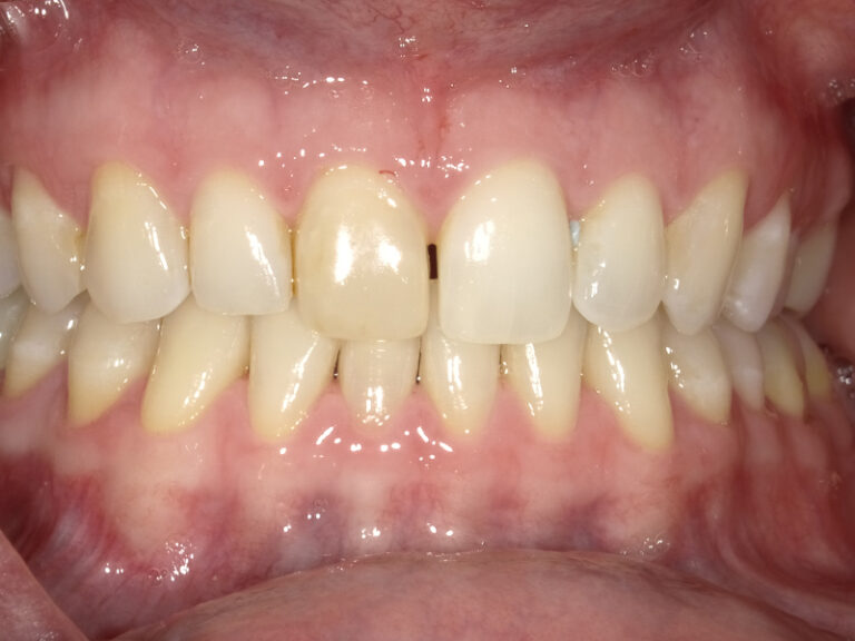  html    head  title 500 Internal Server Error  title   head    body    center  h1 500 Internal Server Error  h1   center    hr  center nginx 1.29.3  center     body     html 