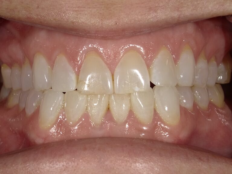 html head title 500 Internal Server Error title head body center h1 500 Internal Server Error h1 center hr center nginx 1.29.3 center body html