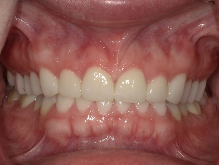  html    head  title 500 Internal Server Error  title   head    body    center  h1 500 Internal Server Error  h1   center    hr  center nginx 1.29.3  center     body     html 