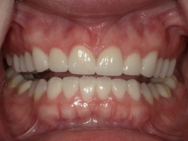  html    head  title 500 Internal Server Error  title   head    body    center  h1 500 Internal Server Error  h1   center    hr  center nginx 1.29.3  center     body     html 