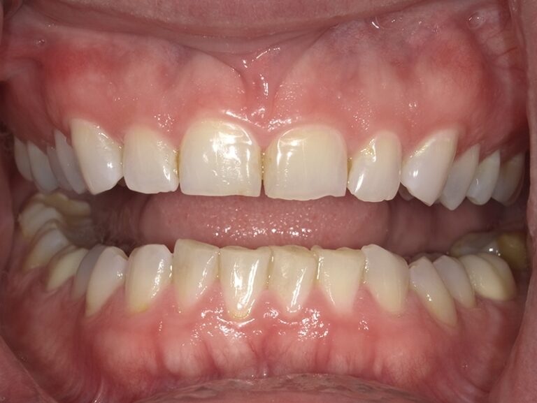  html    head  title 500 Internal Server Error  title   head    body    center  h1 500 Internal Server Error  h1   center    hr  center nginx 1.29.3  center     body     html 