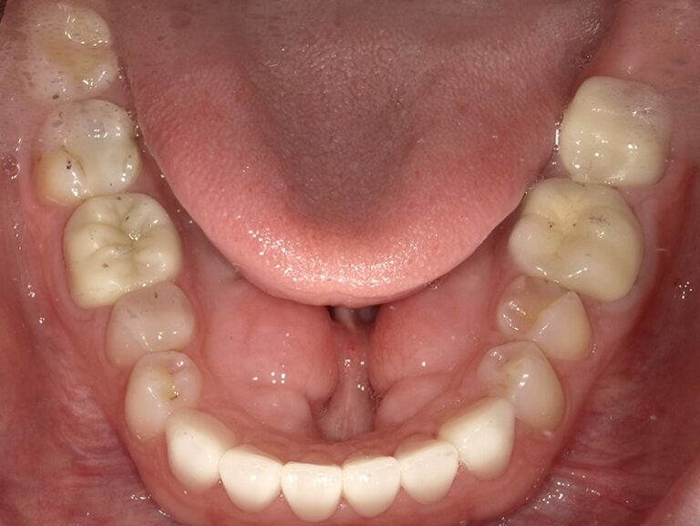  html    head  title 500 Internal Server Error  title   head    body    center  h1 500 Internal Server Error  h1   center    hr  center nginx 1.29.3  center     body     html 