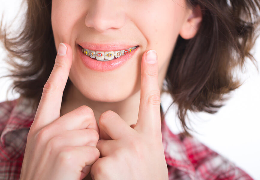kid.braces Vaccaeo Aesthetic